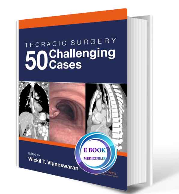 دانلود کتاب Thoracic Surgery: 50 Challenging cases2019 (Original PDF)